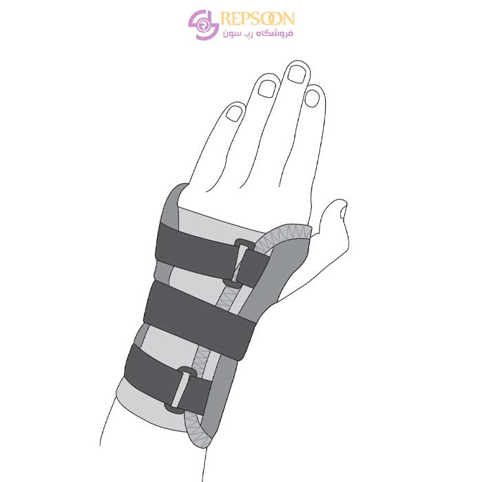 Wristband-and-forearm-with-splint-code-TW33-min----