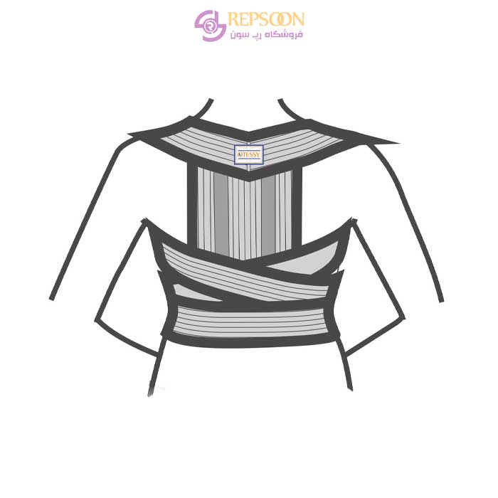 Otsi-splinted-humpback-model-TC-33-min Otsi-splinted-humpback-model-TC-33-min